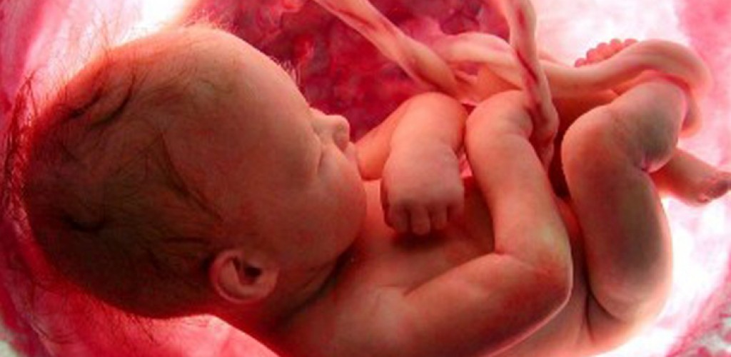 Η Έκτρωση και οι Ευρύτερες Επιπτώσεις της